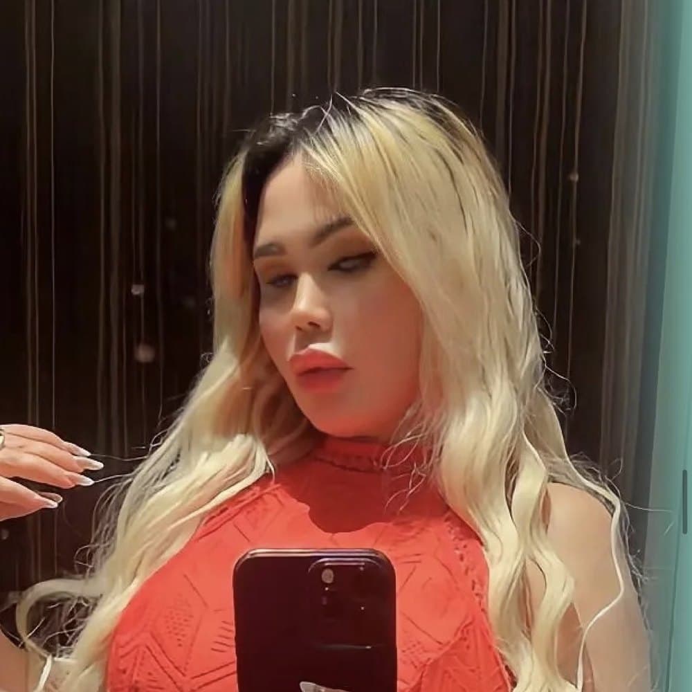 YÜZ & BOYUN GERME sonrası